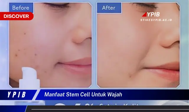 manfaat stem cell untuk wajah manfaat stem cell untuk wajah